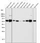 Anti-ALDH2 Monoclonal Antibody